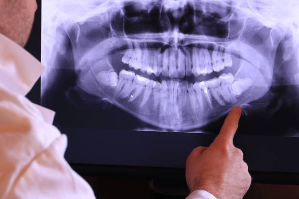 Best Emergency Treatment for Toothache in Mahanoy City, PA