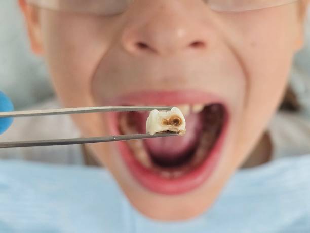 Best Emergency Dental Care for Trauma or Injury in Mahanoy City, PA